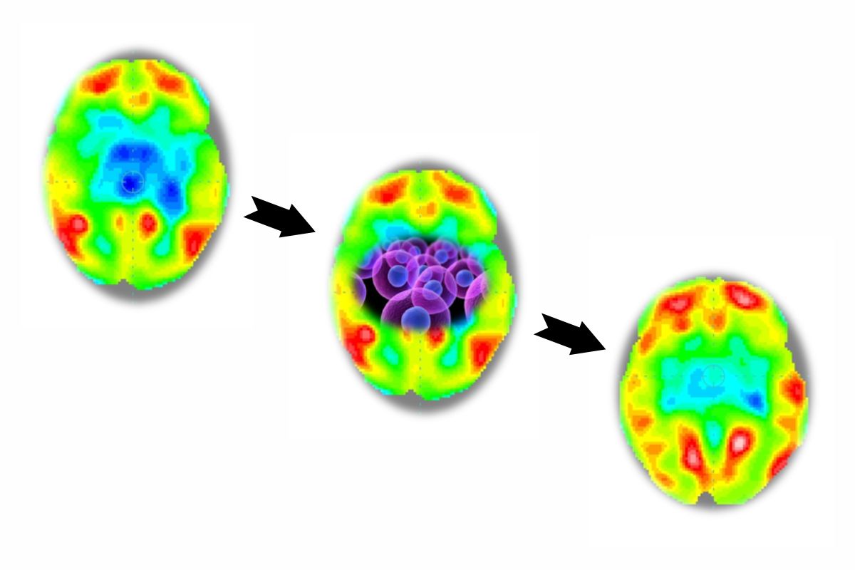 Regenerative Medicine
